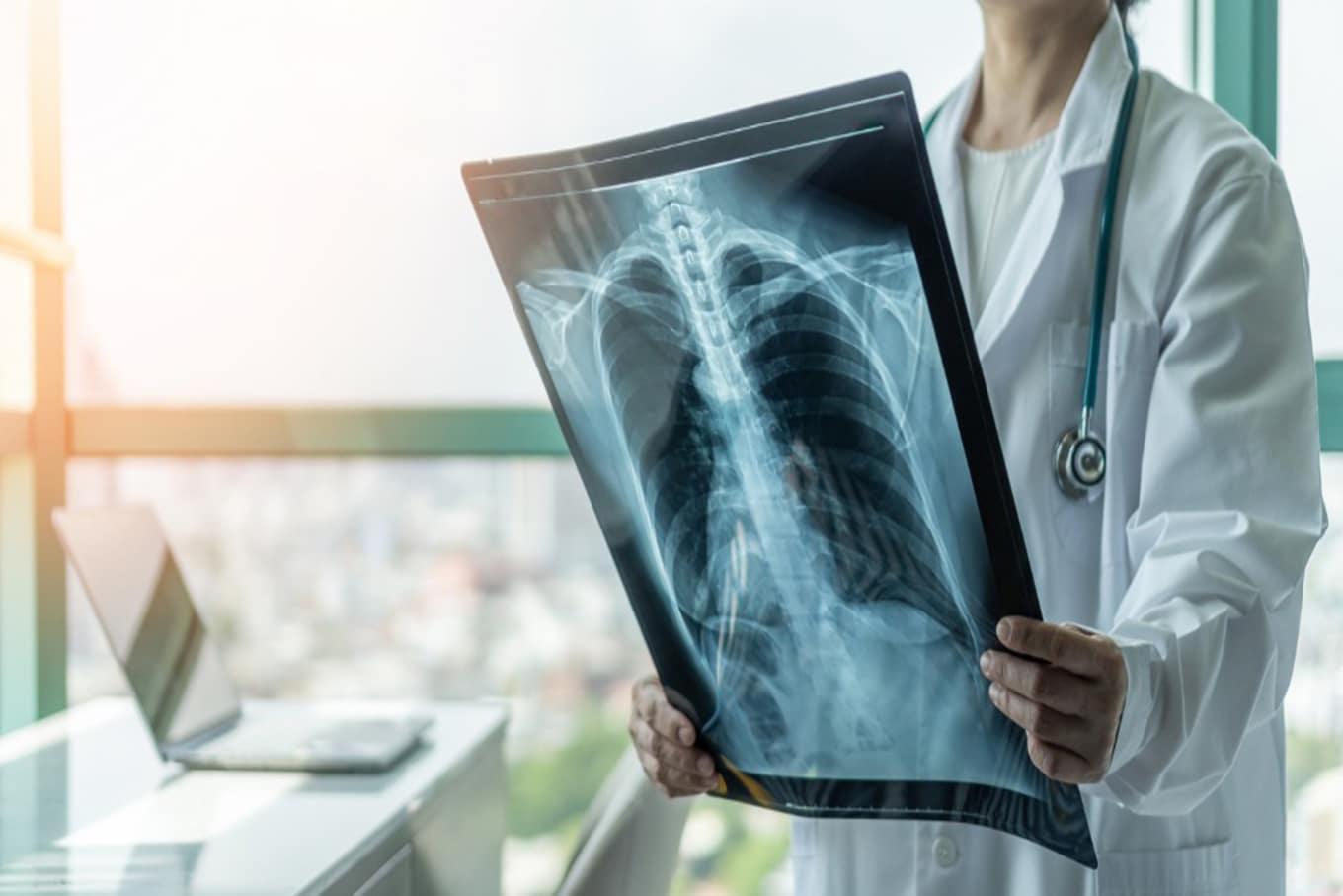 Isenção imposto de renda por tuberculose